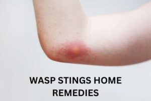 Wasp Stings Home Remedy
